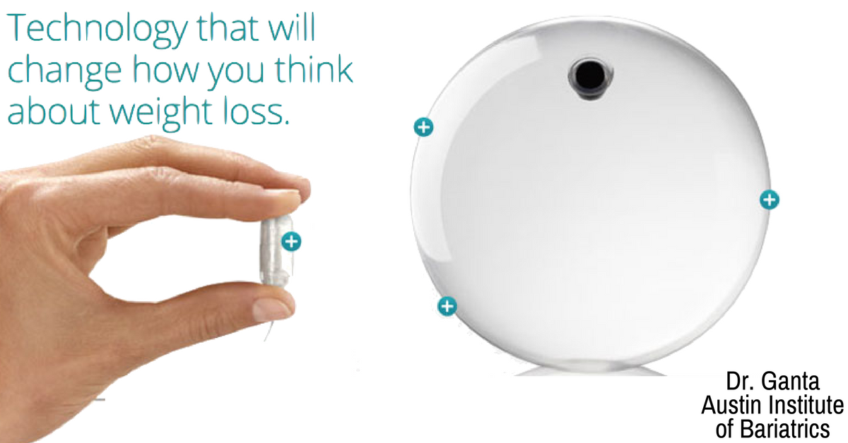 DrGanta's tweet photo. #Obalon is the first and only #swallowable, #FDA-approved balloon system for #weightloss. To learn more: https://t.co/I5IGeYObIW https://t.co/vZL3hOBf8j