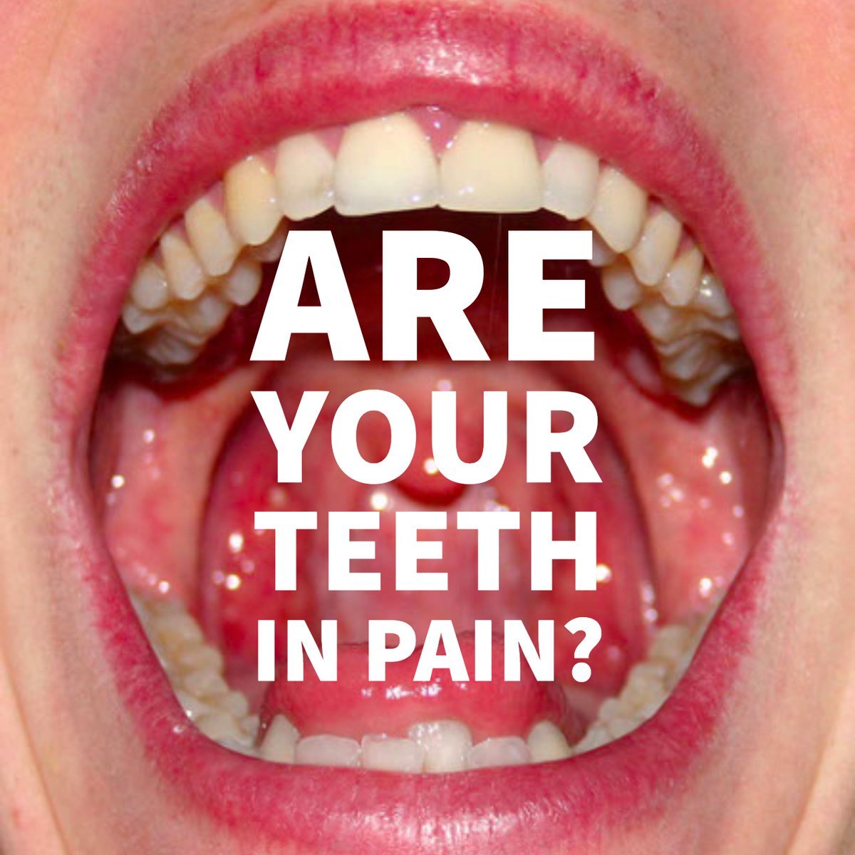 ForsythFaculty's tweet photo. Tooth pain is one of the leading causes for a root canal. Are your teeth in pain? Make an appointment today so we can make the pain go away. https://t.co/NFCcaLAzQf