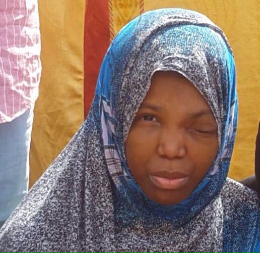 qamarqueen's tweet photo. Katra Omar a 20yrs old cancer patient,dropped school 3 years ago when she was first diagnosed with nasopharyngeal cancer. #SupportDadaKatra https://t.co/VKOFjhjjER