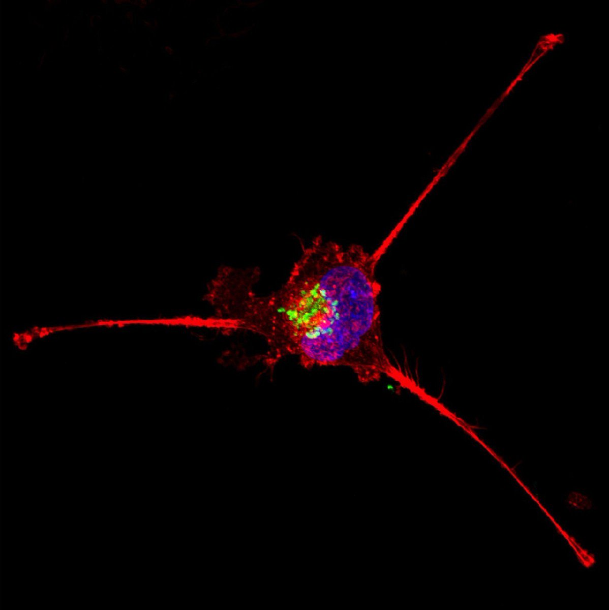 theNCI's tweet photo. Genomic study seeks clues to help explain breast cancer disparities https://t.co/SPMkJ13EEj #bcsm #cancerdisparities #triplenegativebc https://t.co/rBTkj9e4oN