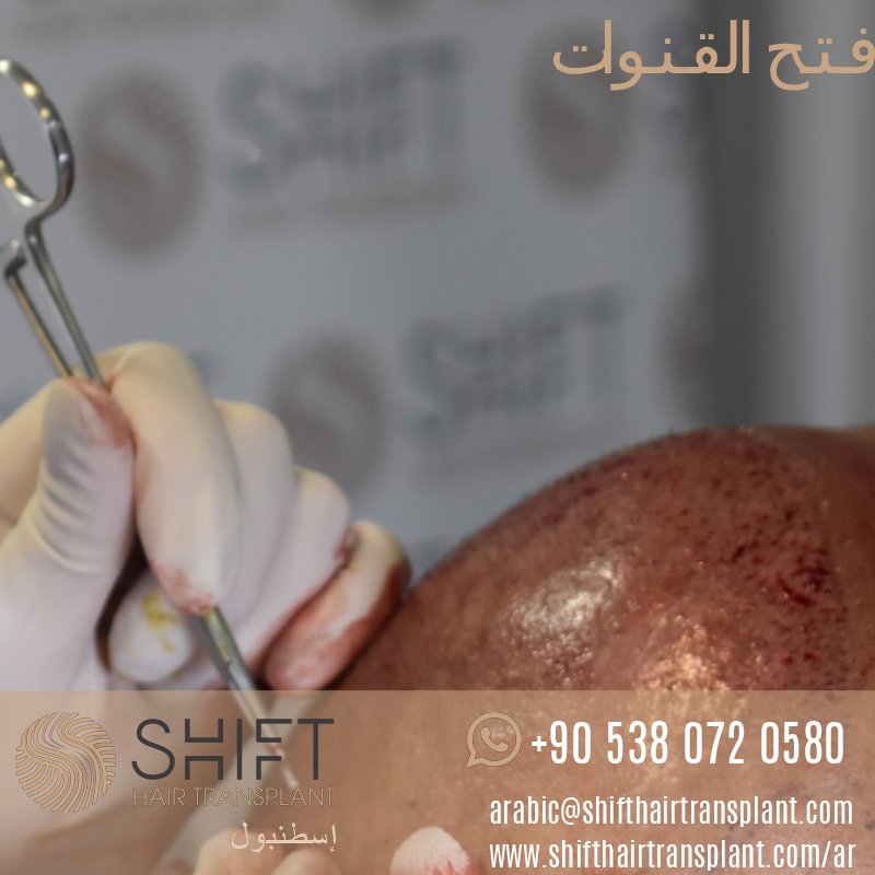 shifthair_ar's tweet photo. #زراعة_الشعر #زراعة_اللحية #زراعة_الشعر_للنساء #زراعة_الحواجب #زراعة_الذقن #زراعة_شعر_الوجه #زراعة_الشعر_في_تركيا #شيفت_لزراعة_الشعر #تركيا https://t.co/I9Y9eVJcP1
