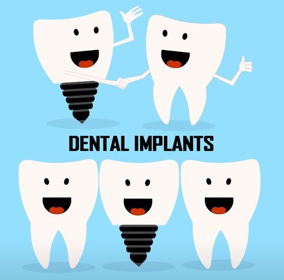 HowardFarran's tweet photo. Are you looking for a permanent way to replace a missing tooth without damage to your adjacent teeth? Dental implants can be long-lasting. https://t.co/bAXVu6dWcb
