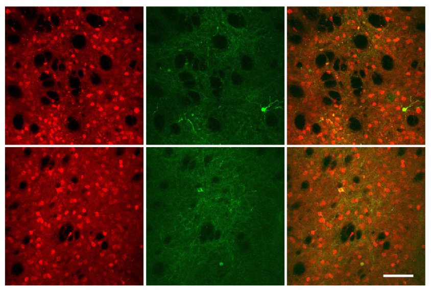 Spectrum's tweet photo. New tool known as iTango may be able to ID brain circuits involved in #autism behaviors. https://t.co/h5tTgEkmuq https://t.co/ZW6OQeNZQt