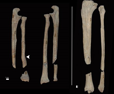 Haunting Discovery: Medieval Skeletons Bear Evidence of Barbaric Punishment ow.ly/GReD30cIAQA <a href="/Archaeorama/">Rossella Lorenzi</a> <a href="/LiveScience/">Live Science</a>