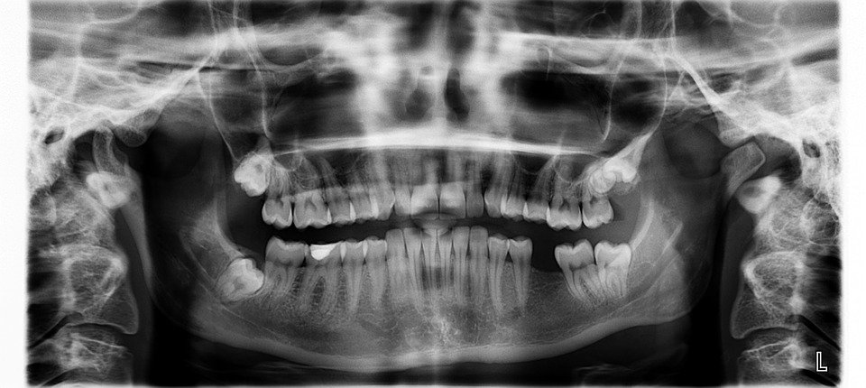 ForsythFaculty's tweet photo. Why are x-rays so important for your teeth? #trustyourdentist Find out here -->https://t.co/O9GbM2i2Ej https://t.co/bpcyIbAgo2
