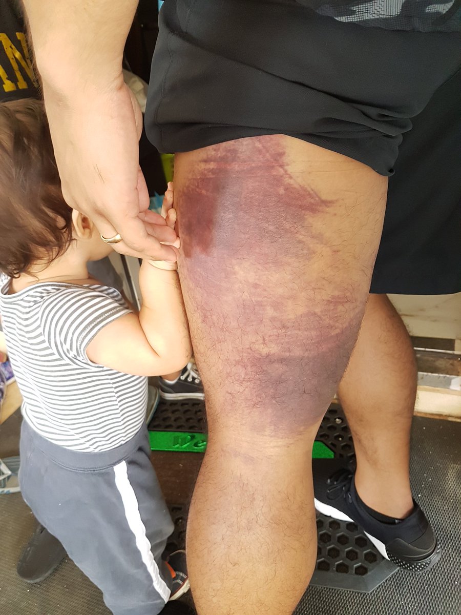 halb acht Stumpf Echt faber leg after jose aldo geh zur Arbeit Verlassen