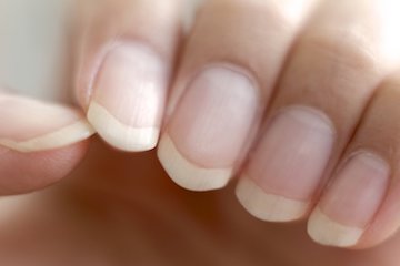 LetsFaceItCare's tweet photo. "6 Things #YourNails Can Tell You About #YourHealth"
https://t.co/CMm9lCSVED
For the #LatestHealthCareNews https://t.co/6nwn55XEO0