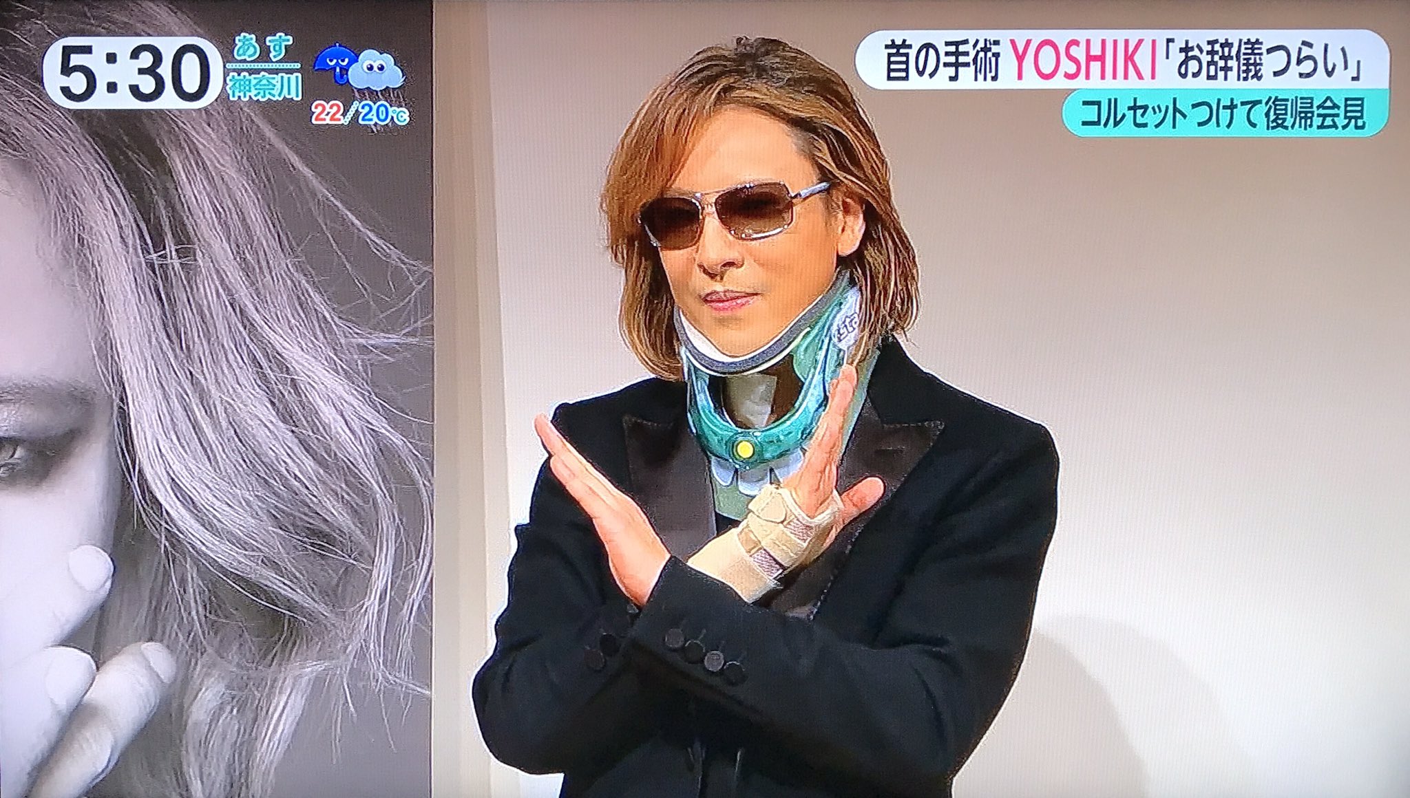 X JAPAN YOSHIKIさんと同じRehab Tech 首 巨大コルセット