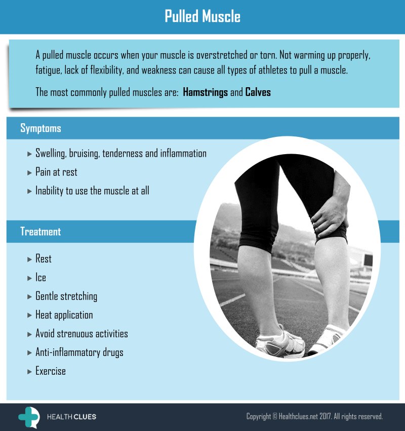 healthclues's tweet photo. #muscle #pull #muscleinjury #musclespasms #musclepull #swelling #pain #sports #injury #treatment #health #fitness #exercise #PT #strength https://t.co/67pPBg1j5e