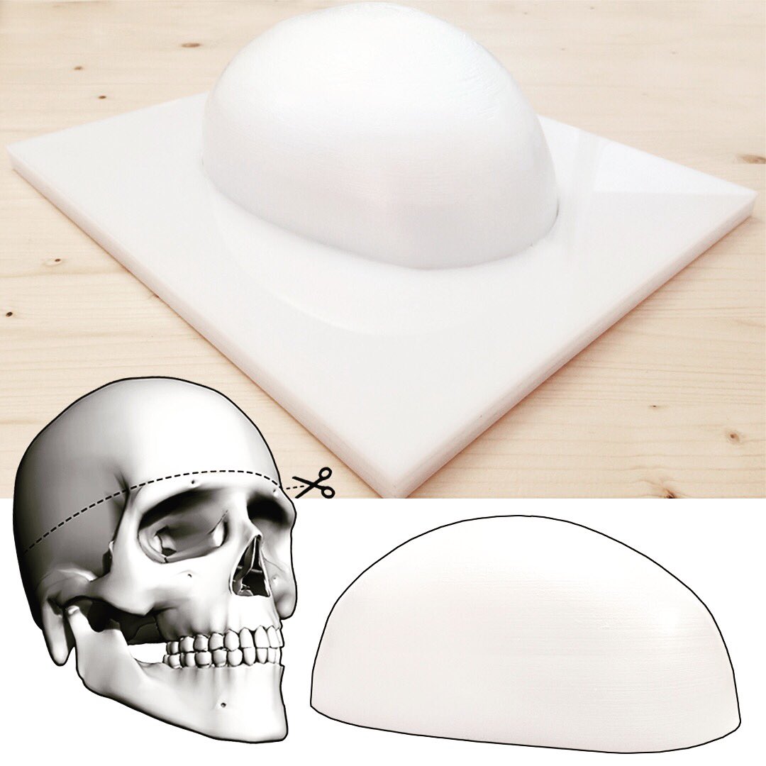 urbanlinkFS's tweet image. Desarrollamos tus proyectos  #3DPrinting #lasercutting #digitalfabrication #fabricaciondigital #neurosurgery #neurocirugia