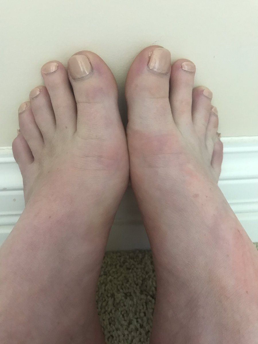 essdm's tweet photo. #footfetish #femdom #findom #AcceptingPaypigs #cashcow #cashquen #feetworship #findomgoddess #footfetishnation https://t.co/kwdqL6HkRm