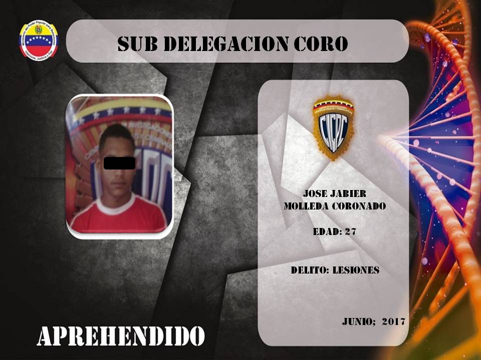 @sdcorocicpc CAPTURA SUJETO POR DELITO DE LESIONES EN EL MUNICIPIO MIRANDA <a href="/cramirezCICPC/">Ramirez CICPC</a> <a href="/cacsvzla/">Cesar Cardenas</a>
