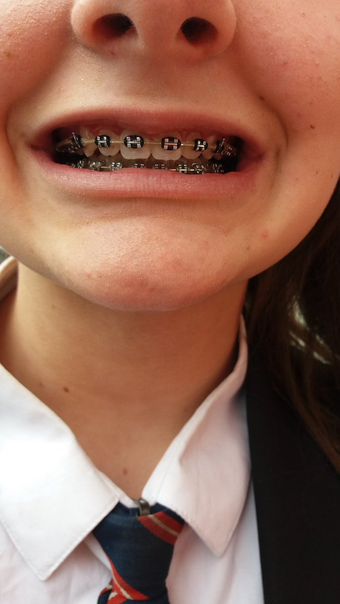 Thanks to all the staff <a href="/ClevelandOrtho/">ClevelandOrthodontic</a> for my girlie s new braces and their even bigger confident smiles