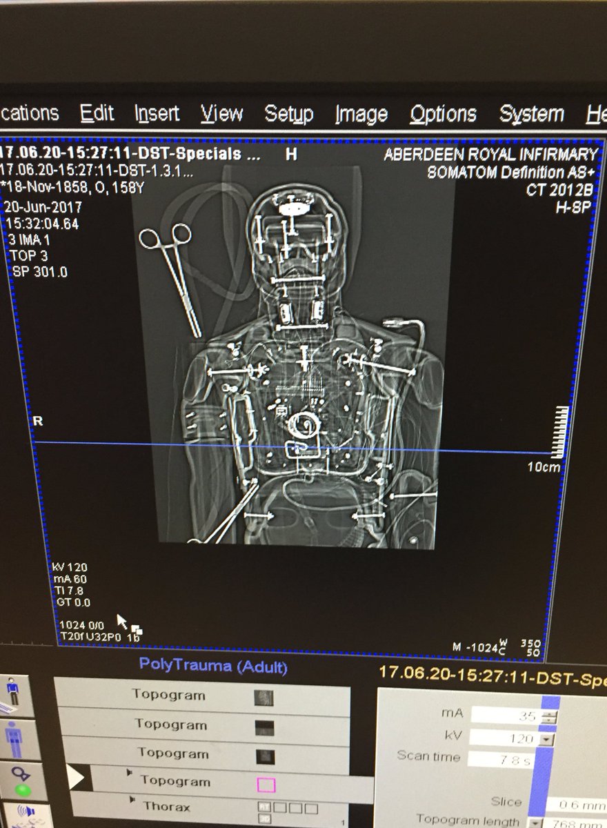 AberdeenICUEdu's tweet photo. Looks a bit like we've cannulated Iron Man. ECMO simulation in the CT Scanner #practicetoimprove @AberdeenICUEdu https://t.co/aZR3t0BpxV