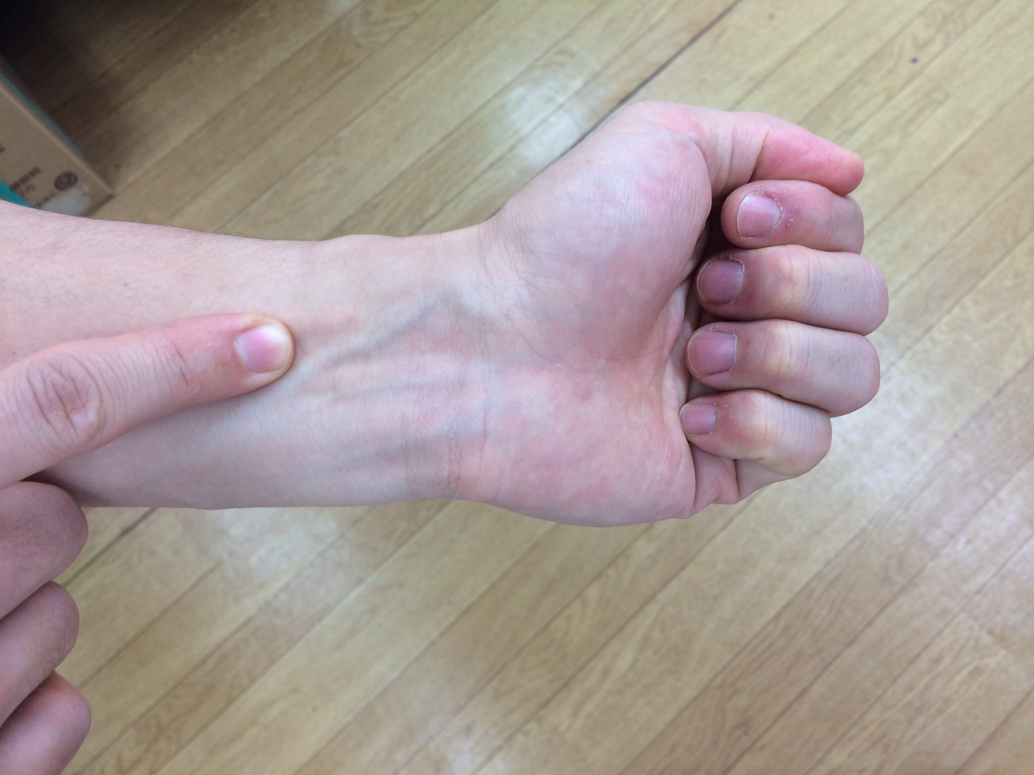 片頭痛や肩こりの酷い人必見 内関 のツボがおすすめ 話題の