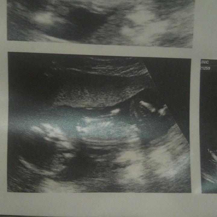 LayneMika's tweet photo. It's a boy! https://t.co/kZy4fjl03F