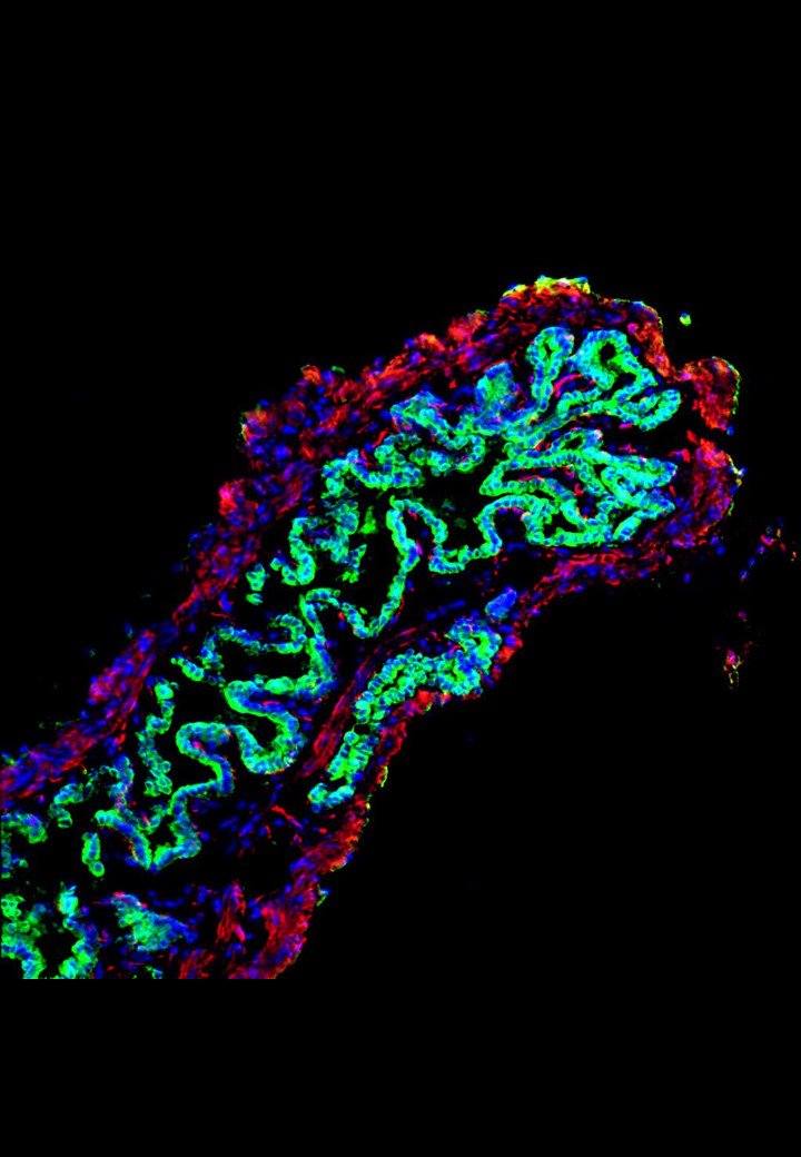 SCICambridge's tweet photo. 3D cell scaffolding supports future transplant therapies https://t.co/2J3spAR0M8 @VallierLab https://t.co/ZDFvg2Otmp