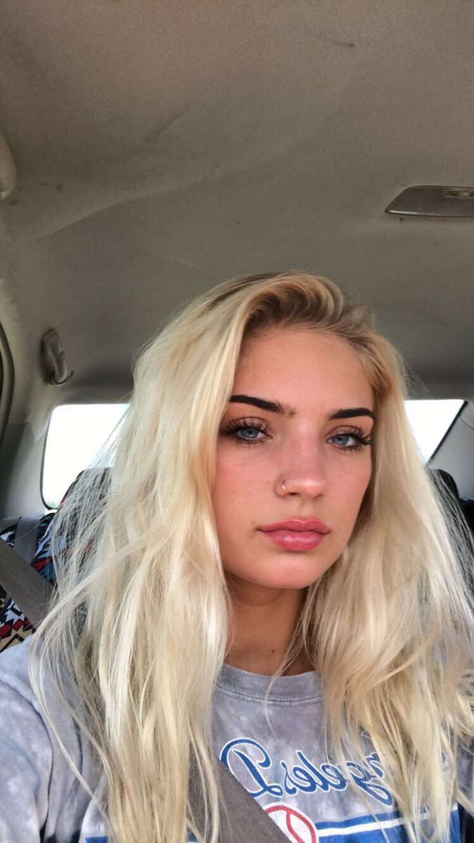 wallkriss's tweet photo. back to a time when my cheeks weren't swollen out the ass https://t.co/mXKnH9A4N4