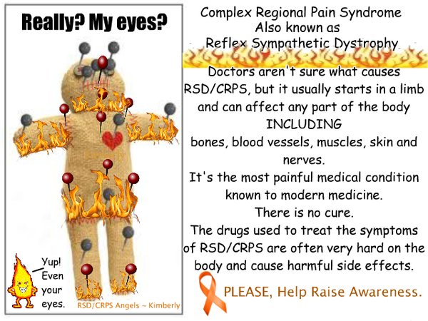 pmck0001's tweet photo. CRPS/ RSD “The Suicide Disease” is the most painful medical condition known to modern medicine! @alibali50 https://t.co/pvitebHyBo