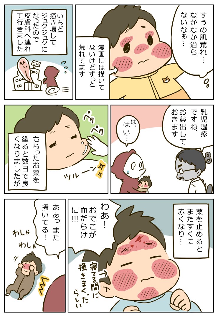 肌荒れ 0歳4ヶ月 T Co Eatp3dvwqs いずみえも 単行本発売中 の漫画