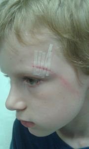 musingstiredmum's tweet photo. A huge THANK YOU to the hospital staff and strangers who helped us when Matthew bashed his head https://t.co/D6ojenVJBs https://t.co/MWTHcKtxlH