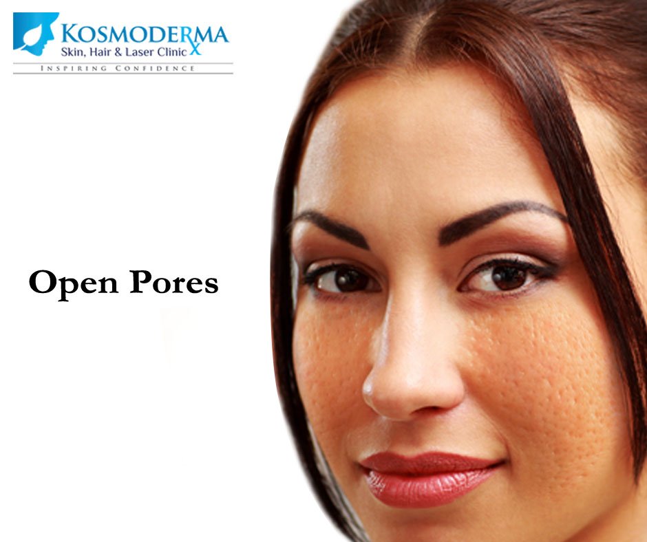 Kosmoderma's tweet photo. Ageing Prematurely? Check 4 #Hyperpigmentation, #SkinSag #FineLines #OpenPore #SkinPatches visit https://t.co/Qvf1EvN6JF #Kosmoderma https://t.co/O36SiIEX9B
