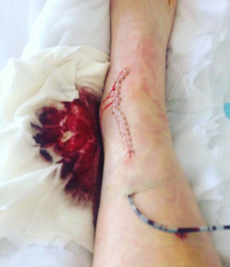 2017 season so far has been filled with epic adventure &amp; A&amp;E #femaleridersraceteam #mtb <a href="/fridersinc/">f-riders-inc</a>