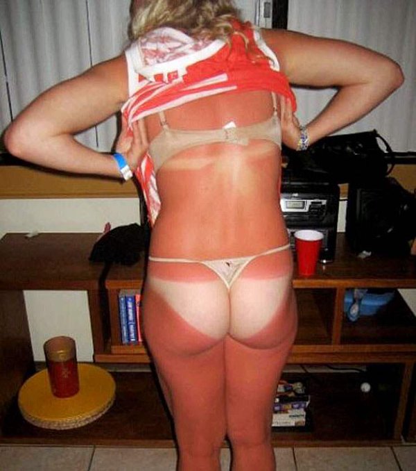 rezocoquin's tweet photo. Cet été pensez à mettre de la crème ! #coupdesoleil #bronzette #çachauffe #hot #rezocoquin #humourestival #nonmaislol https://t.co/8DHY9z4zTZ