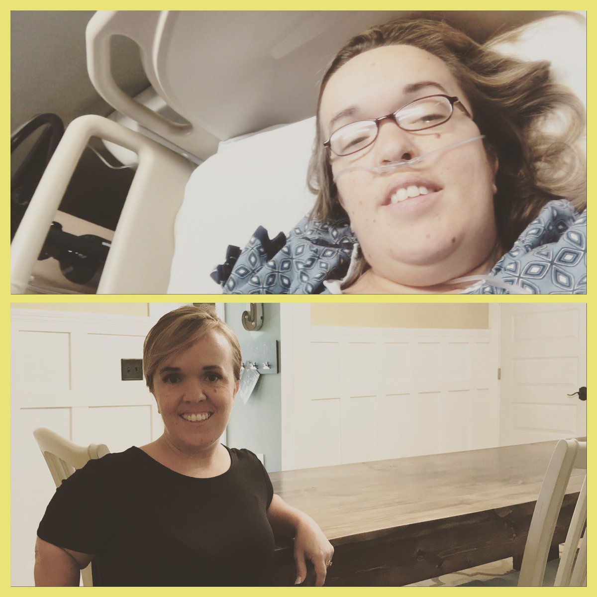 team7lj's tweet photo. What a difference a week makes! #1weekpostop #suckitspinalstenosis #7littleJohnstons #cantkeepmedownlong https://t.co/DTTBwPR2ky
