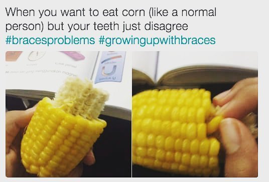 Awwww I miss you #cornonthecobb🌽  #braces ift.tt/2uHWxd2