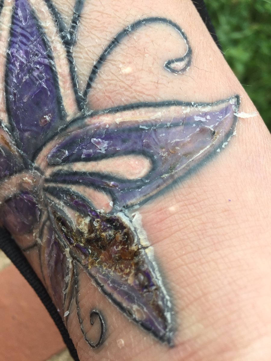 kchesterton22's tweet photo. @TheSun what a story about how my foot has been left like@thos@after the worse tattoo ever!!! https://t.co/tE33zomgXb