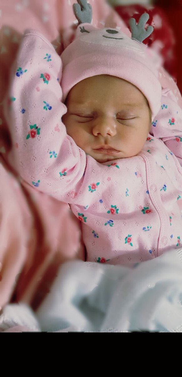 3 aylık bebeğimiz yeğenim Duru'ya bugün lösemi teşhisi konuldu! Çok acil BRH+ kana ihtiyacımız var!! 9 eylül üniv.5333842864 <a href="/sibel_yucel/">Sibel Ayşe Yücel🚨</a>