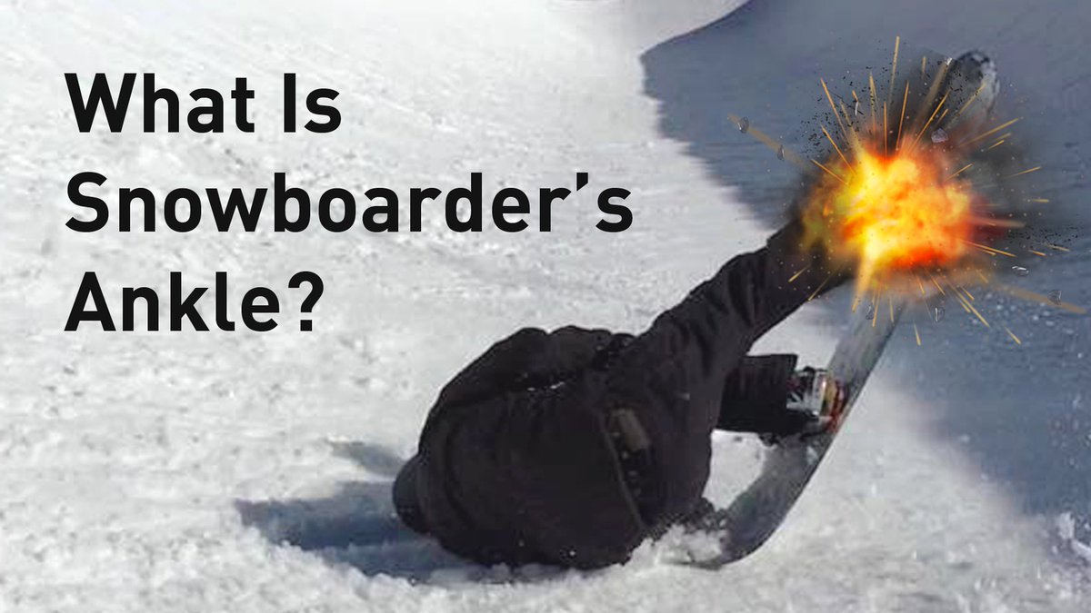 Sprained ankle or snowboarder's ankle? #injury #ankle #snowboarding #snowboard #geek #sportscience

Read here==> onyxsnowboarding.com/blog/2017/06/s…