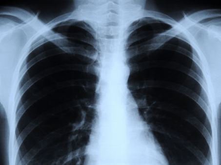 What are X-rays and how are they used in the food industry? #science #radiation #safety tinyurl.com/j57s2bf