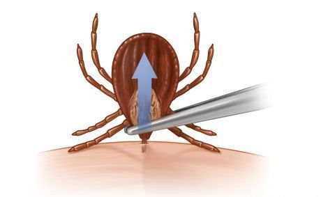protectfully1's tweet photo. #camping #walking #playing #outdoors ? UK Tick numbers are on the rise. Check your family &amp; remove properly https://t.co/tB62sDVktA https://t.co/OlMRJDROhw