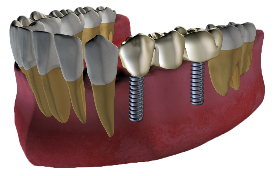 WinTerraDental's tweet photo. Explore 4 different views of each jaw in 3D realistic view of the #odontogram. 
#SmartChart #Dental
Visit our site: https://t.co/MciNANzcgE https://t.co/6Jq2rd7QZD