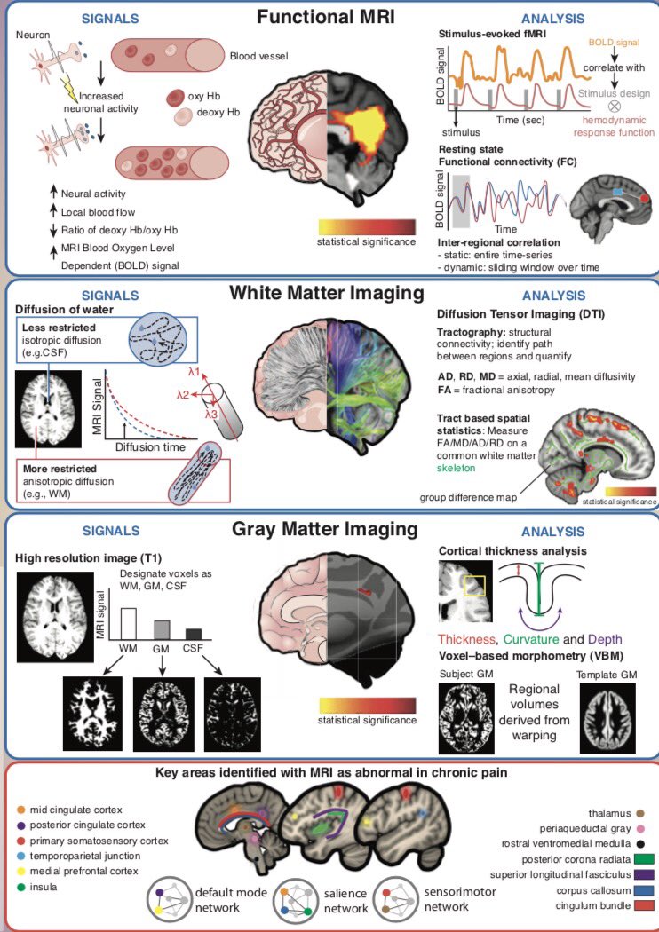 👍 great info on visualizing brain in persistend pain
<a href="/NOIExplainPain/">NOIExplainPain</a> <a href="/kjartanfersum/">Kjartan Vibe Fersum</a> <a href="/BobVermeeren/">Bob Vermeeren</a> <a href="/PeteOSullivanPT/">Peter O'Sullivan</a> 
journals.lww.com/pain/Fulltext/…