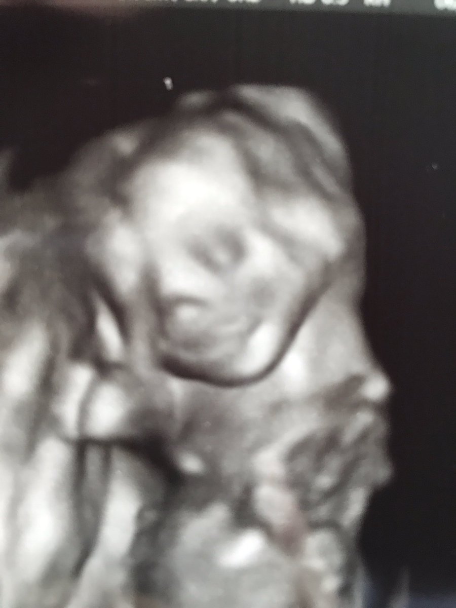 ADeckerNews's tweet photo. My wonderful husband @BuckleyTunison and I are so proud to announce we are going to be mom &amp; dad to this gorgeous boy! Due in November!! ❤❤❤ https://t.co/iiehrrRg7a
