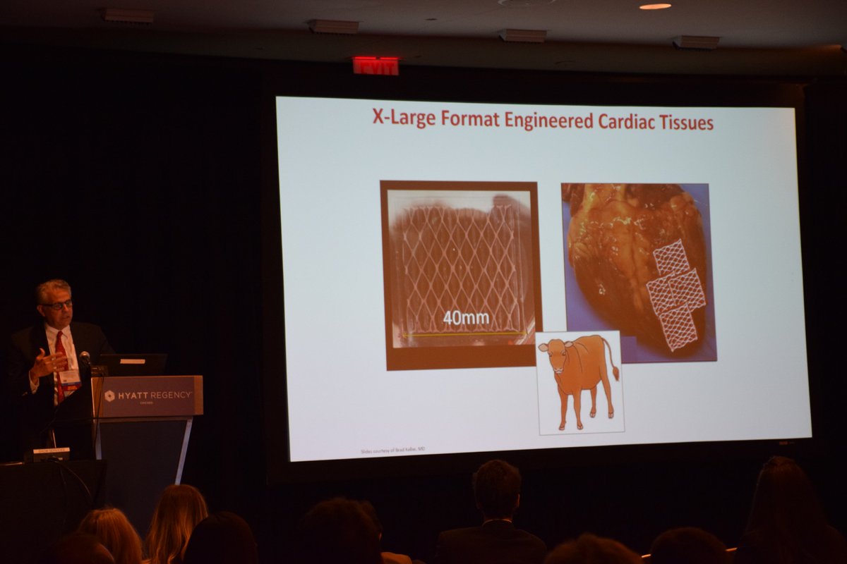 asaiojournal's tweet photo. Scenes from Editor-in-Chief Dr. Mark Slaughter's talk: Future Challenges with #MCS  #ASAIO2017 https://t.co/eJCua7fr1D