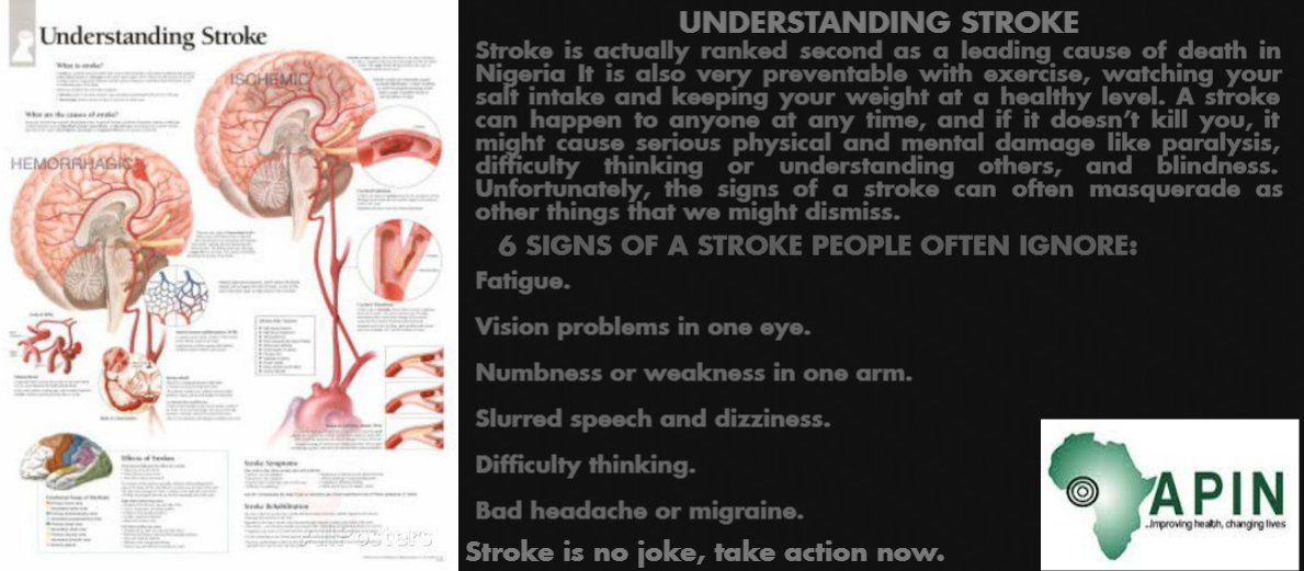 APINNigeria's tweet photo. @APINNigeria understanding stroke. #Strokeisnojoke #Takeactionnow. #APINInitiatives @CDCNigeria @EpiAFRIC https://t.co/K1BS7kIgjG
