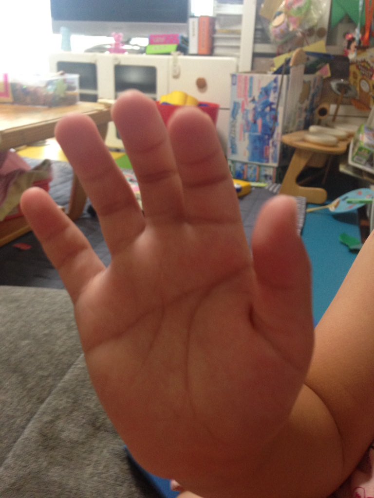 映画 亜人 公式アカウント 4月18日blu Ray Dvd発売 天下取りの手相 亜人 佐藤健さんの手を見てほしい マスカケ線 突然の手相