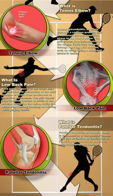 X 上的Mount Sinai Health System:「How do you treat lower back