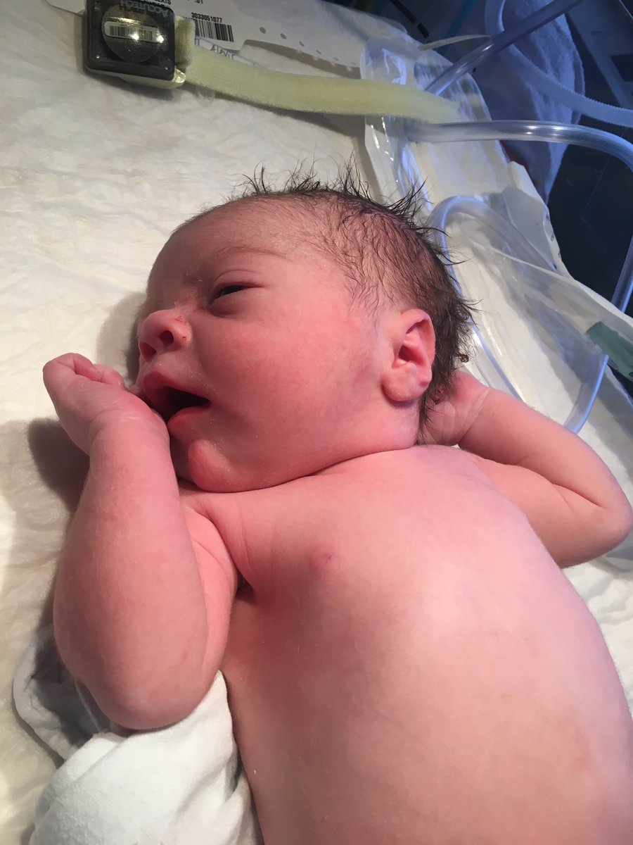 sorryimlexi's tweet photo. - Penelope Lorayna Clemons, 6 pounds 15 ounces, 19.5 inches long, 1:55pm. she is absolutely perfect @surielnotcereal https://t.co/CFMZzXpvgT