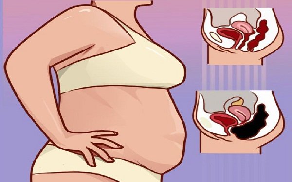 nutrilover's tweet photo. 6 Reasons You’re Not Losing Weight - https://t.co/LQYgB3RjQp https://t.co/ZKgSSWX9Vt