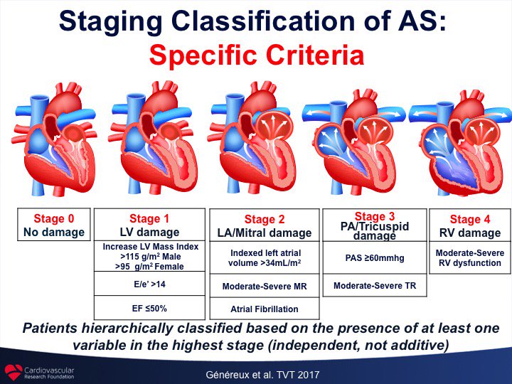 Aortic Stenosis Stages