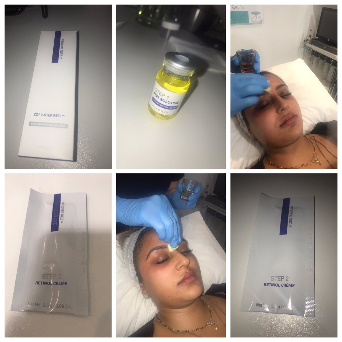 mayfairpractice's tweet photo. The @zoskinhealth #3steppeel designed to treat #acne #melasma sun damage, fine lines, large pores and dullness available at the practice. https://t.co/EKiiZpgXwa