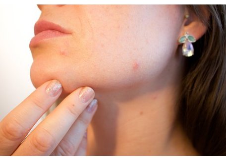 ClinicSloane's tweet photo. 5 Reasons Of Adult #Acne You Don’t Know :-
https://t.co/U9feY96aRU
#PlasticSurgery #cosmeticsurgery https://t.co/fcC3IyhO0v
