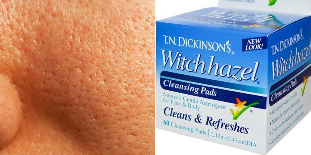 Oily Skin Products: The Best Makeup and Skin Care Buys for Oily Skin glamour.com/gallery/best-p… #BeautyProductReviews