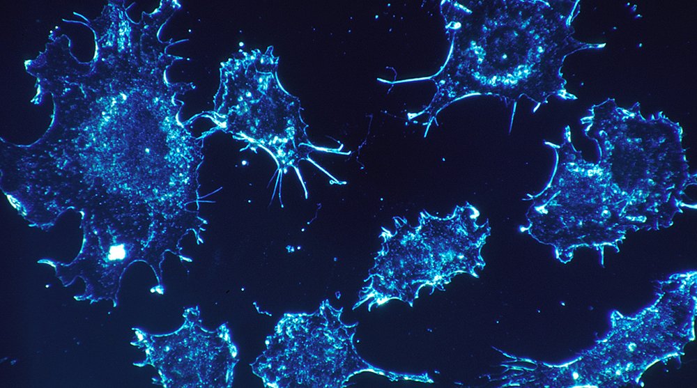 NEWS: Researchers identify how ovarian cancer hijacks natural cell process to survive > ow.ly/faJ430cVec4