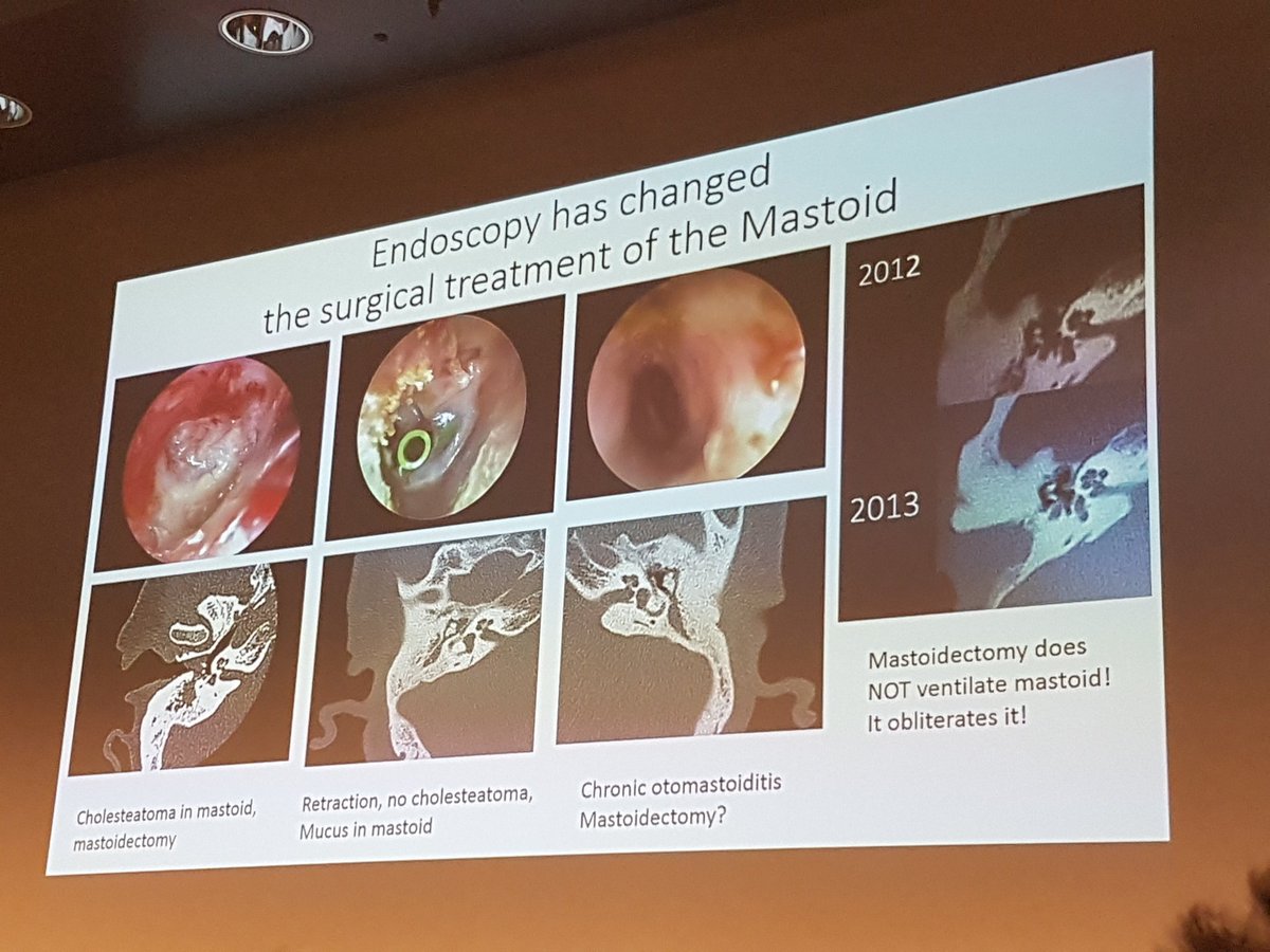 ORL_Sluh_Govor's tweet photo. Great lecture by Manuela Fina on ear endoscopy #ifos2017 #ENTsurgery https://t.co/QyQ7zBqMPF